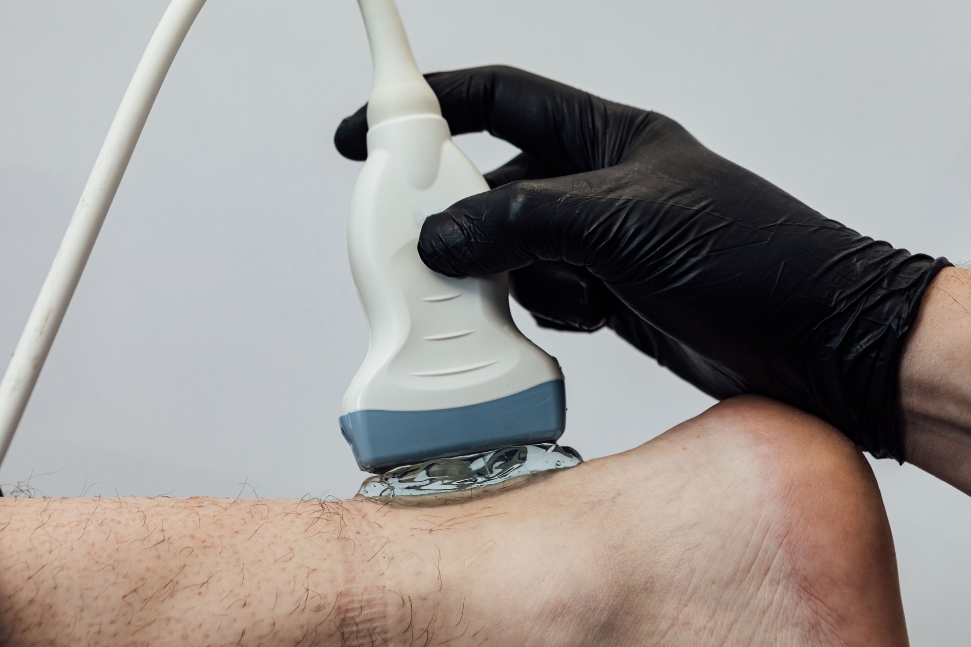 Detail der Hand bei einem Ultraschall-Scan der Achillessehne